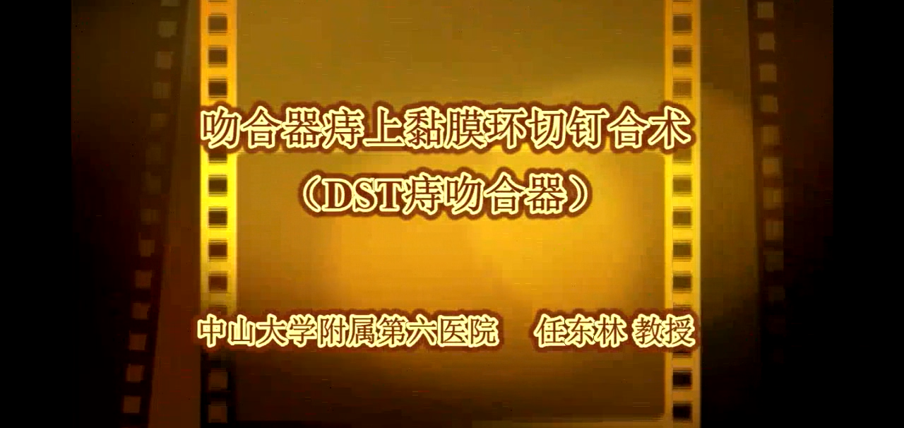 吻合器痔上黏膜环切钉合术中华人才网校-专业技术人员继续教育平台